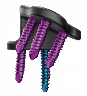 2-DPO_2_VT2-312X_0_1_DPO_Seite_12